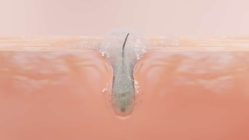 โฟมล้างหน้าลดสิว