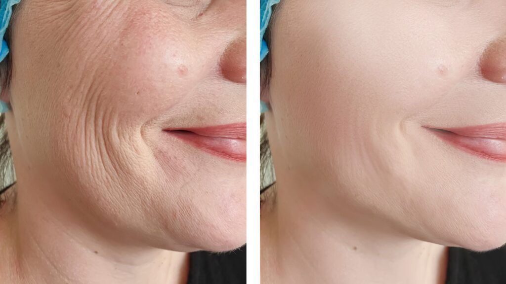 เรตินอล