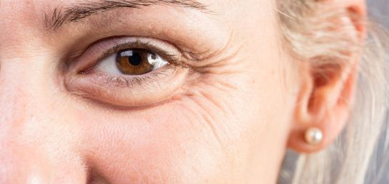 ลดริ้วรอย