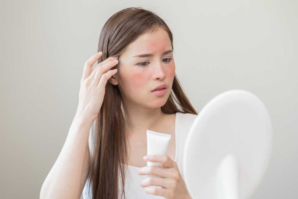 หน้าแดง