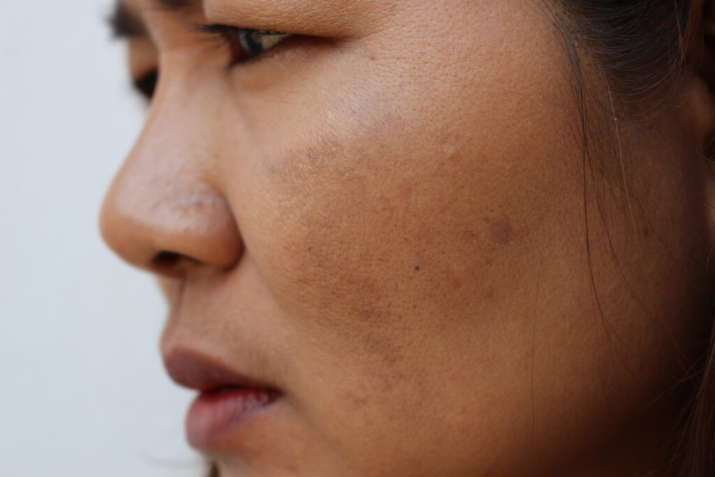 หน้าหมองคล้ำ