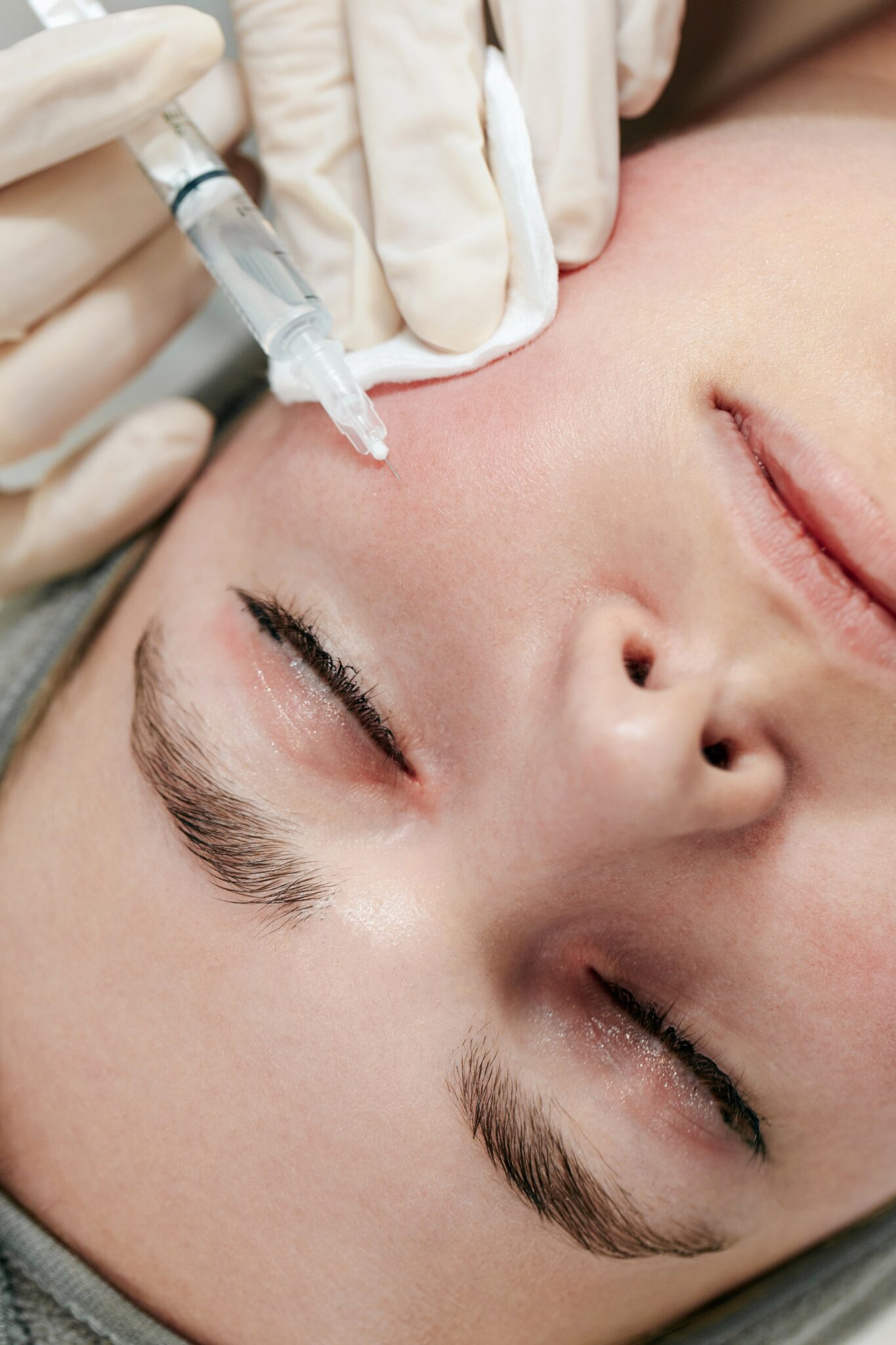 เมโสหน้าใส